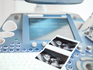 FERTILITY OPD 2 Samprada Hospital Untitled design 19 Samprada Hospital